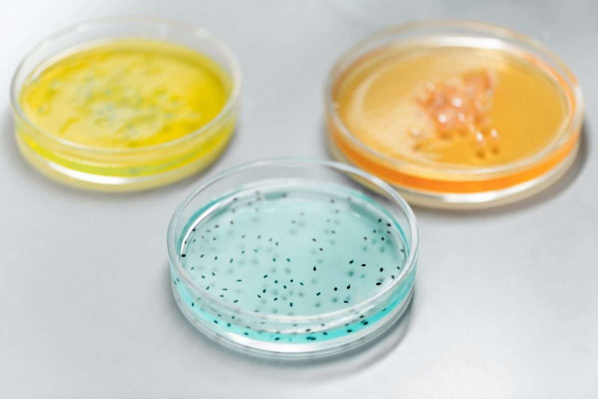 Glass dishes with cooloured liquids in them